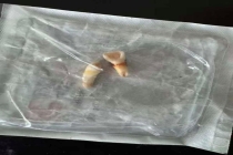 男孩遭母亲男友殴打致轻伤二级 施暴者已被刑拘