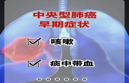 它，死亡率居癌症首位！高危人群警惕