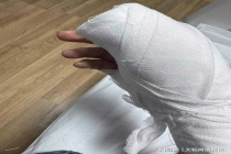 客服回应刀具裸装割伤医学生手神经 安全意识引热议