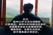 男子睡前开窗被凉风直吹，一觉醒来成面瘫