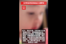 铁头功？3岁男孩一头把奶奶撞成小肠穿孔