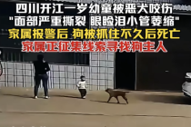 恶犬咬伤幼童被抓不久后死亡 事件引发广泛关注