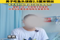 鱼刺门诊不局限于取鱼刺 男子吃鱼头误吞2.5厘米钢丝