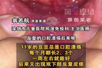 男孩每月长口腔溃疡确诊白塞病 医生提醒