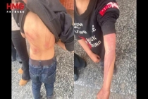 咸宁姐弟遭生父继母虐打 悲惨遭遇曝光