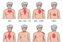 为什么猝死会盯上看似强壮的年轻人 高强度工作与不良习惯的警示